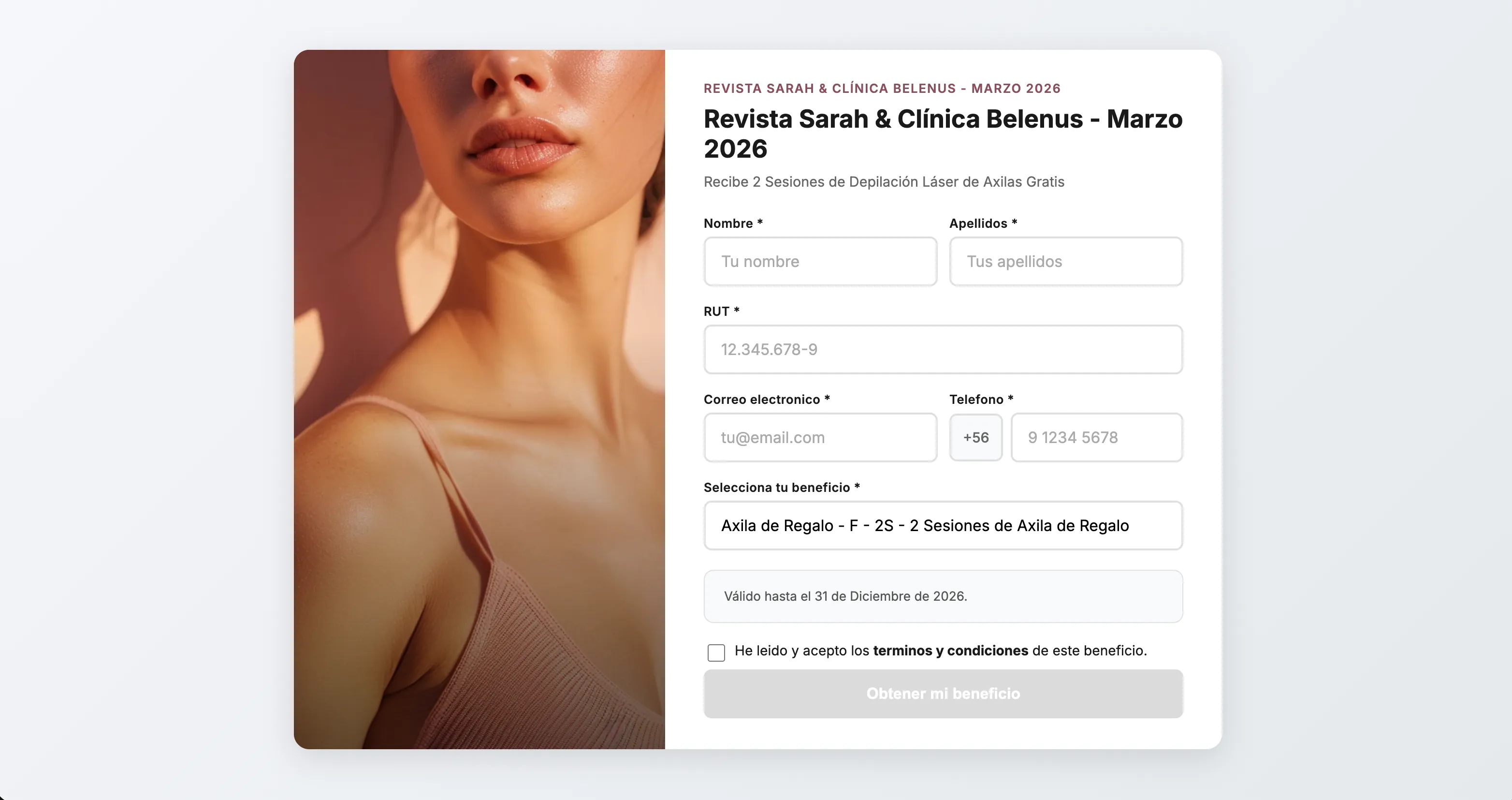 Formulario público del convenio DEMOSTRACIÓN & Clínica Belenus